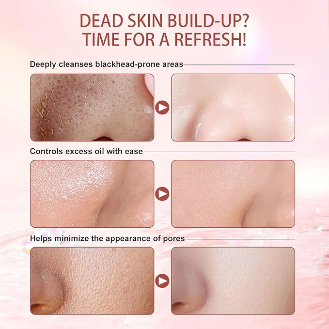 2 Pack Gentle Purifying Exfoliating Gel for improving Skin Tone & Texture, Deas Skin Cells/Pore Dirt/Excess Sebum/Impurities Remover, Hydration, Natural Formula, 1.76 Oz/50 G