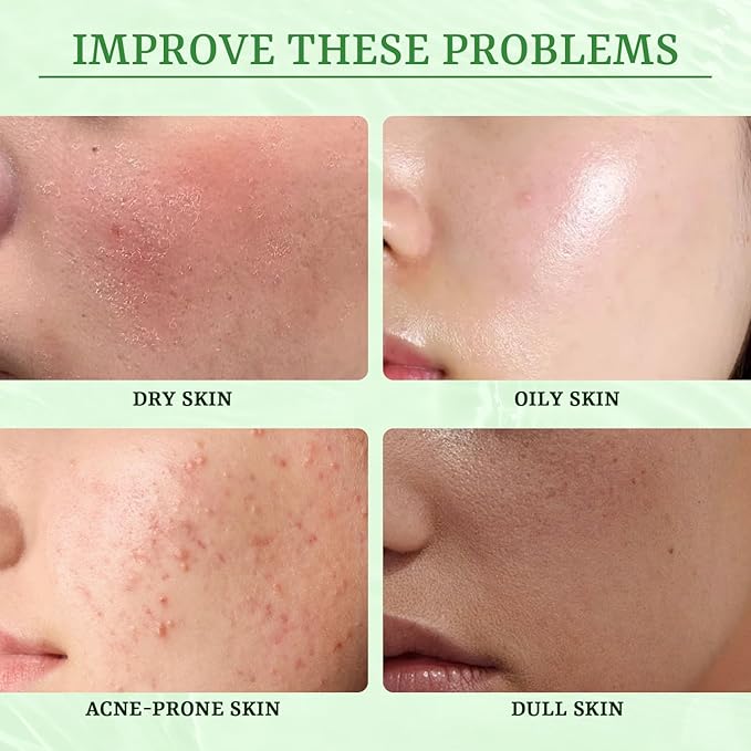 Anti Acne Face Mask Salicylic Acid Face Masks Skincare, Hydrating Face Masks, Soothing Facial Sheet Mask Skin Care for Acne Prone, Acne Mask for Pimple Breakouts Oil Control, 10 Pack